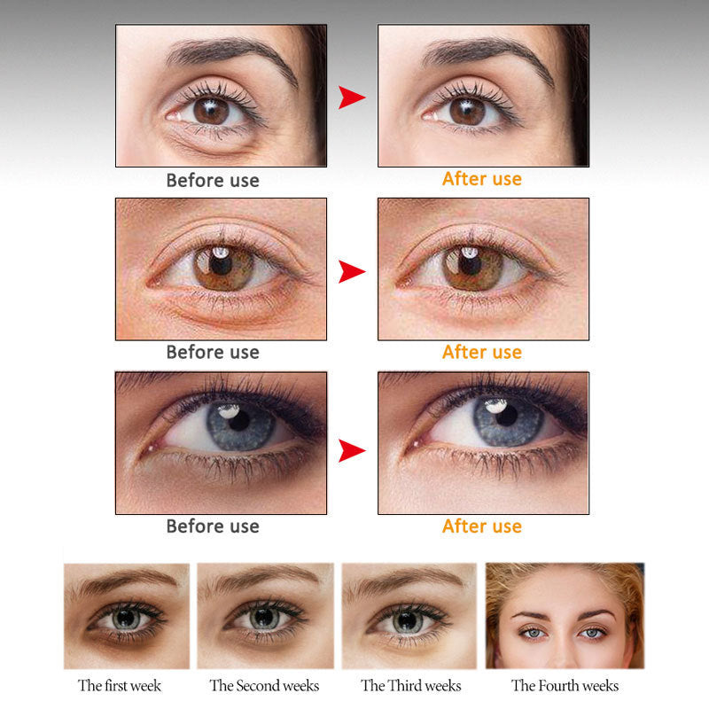 ArtisCare Eye Cream – Anti-Dark Circles & Firming Hydration