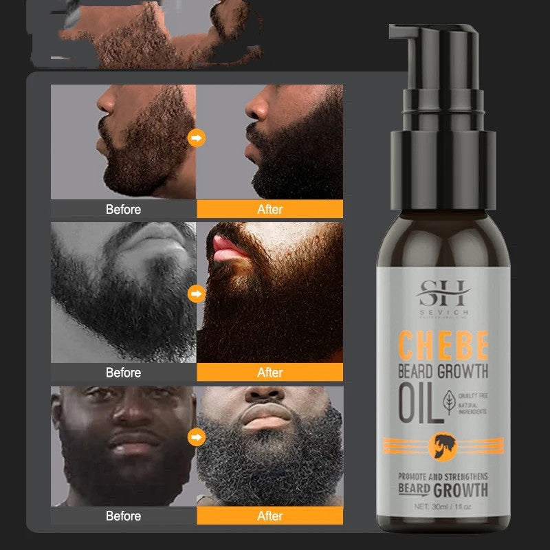 🧴 Natural Chebe Men Beard Growth Oil – Fast & Effective Hair Loss Treatment