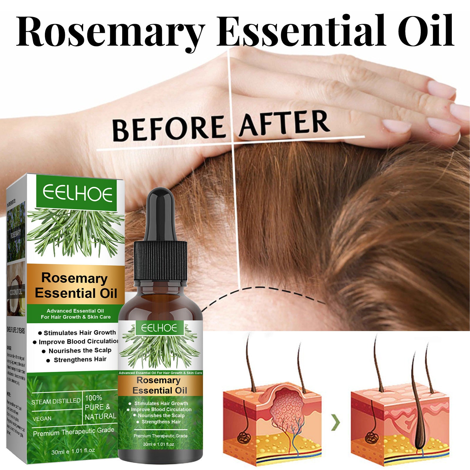 🌿 Rosemary Hair Care Essential Oil – Anti-Hair Loss, Growth & Scalp Nourishment