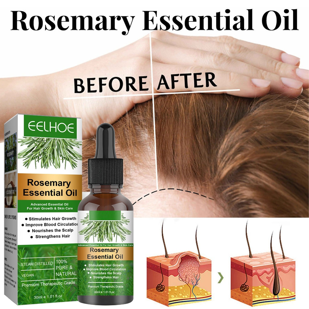 🌿 Rosemary Hair Care Essential Oil – Anti-Hair Loss, Growth & Scalp Nourishment