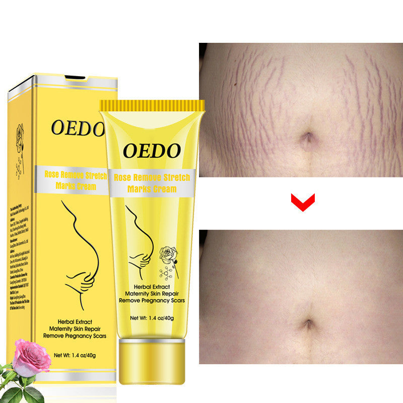 🌹 Rose Stretch Mark Removal Cream – Anti-Wrinkle & Skin Firming Moisturizer