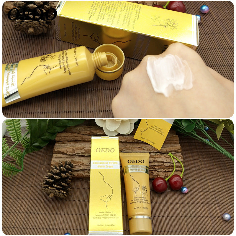 🌹 Rose Stretch Mark Removal Cream – Anti-Wrinkle & Skin Firming Moisturizer
