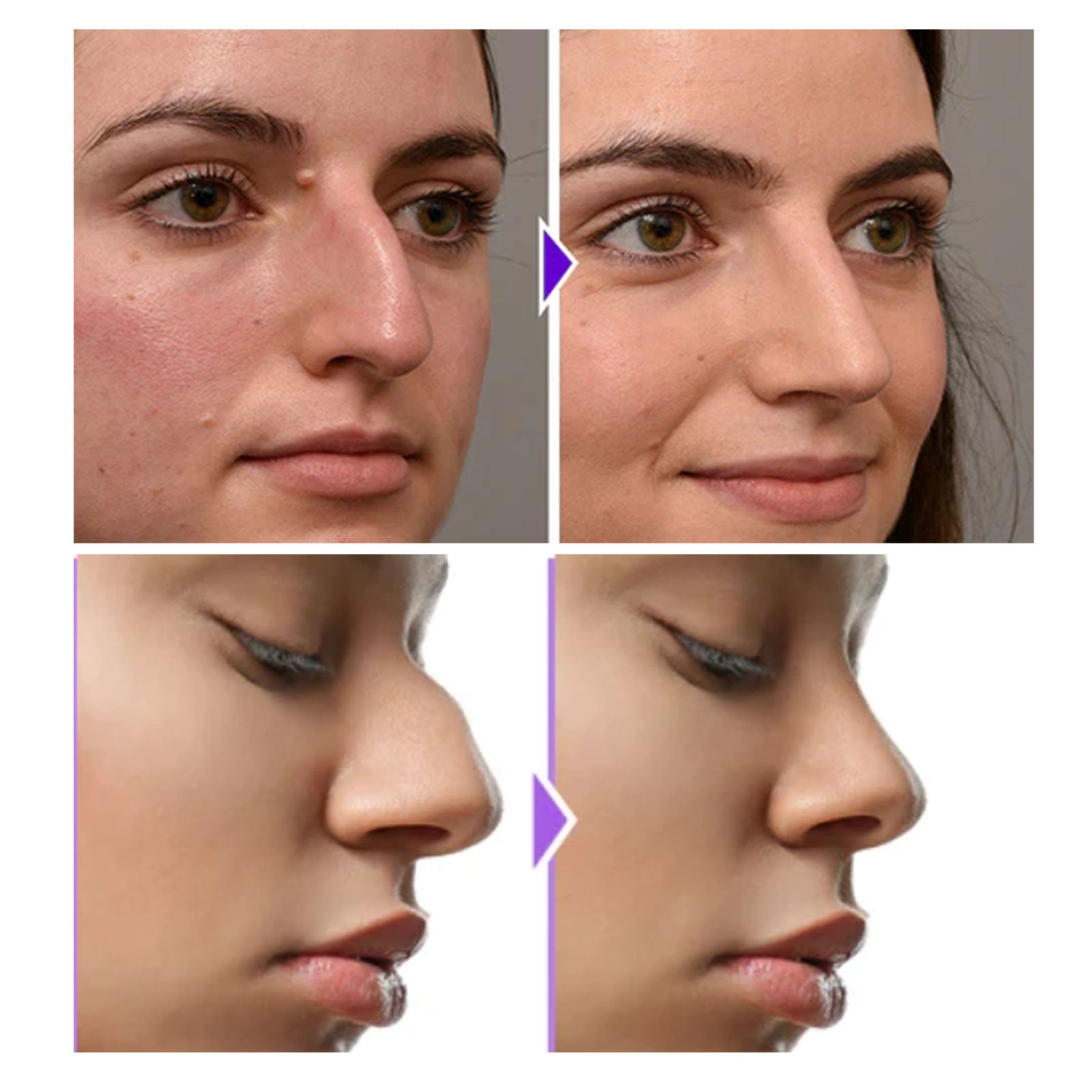 🌟 EELHOE Nose Shaper – Natural Nose Lifting & Contour Enhancer