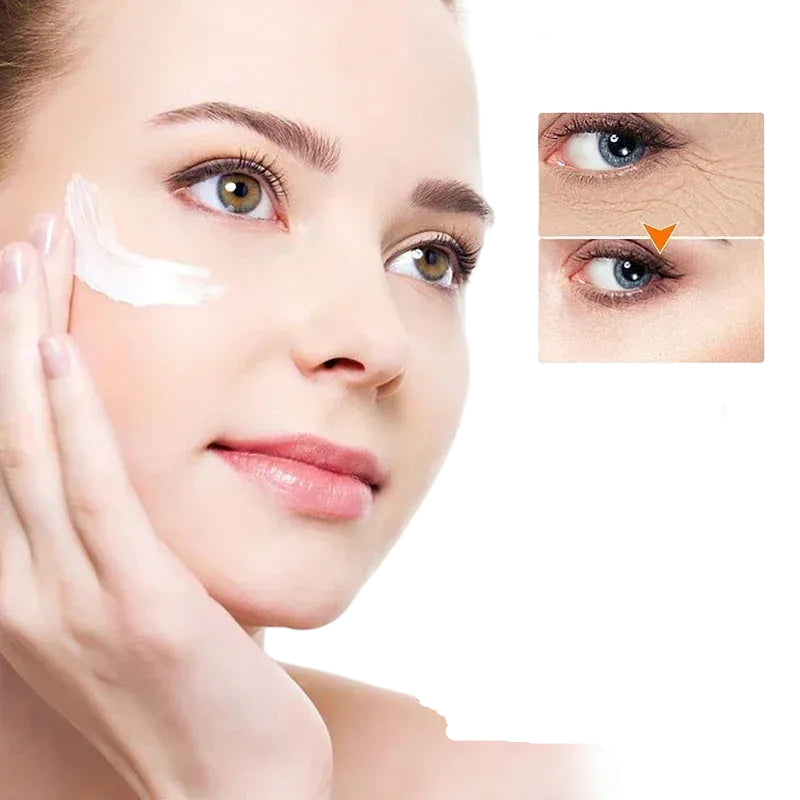 Retinol Eye Cream – Lifting & Dark Circle Treatment