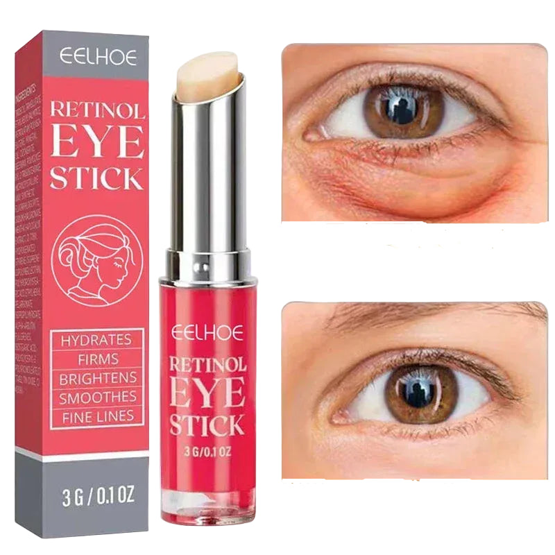 Retinol Eye Cream – Lifting & Dark Circle Treatment