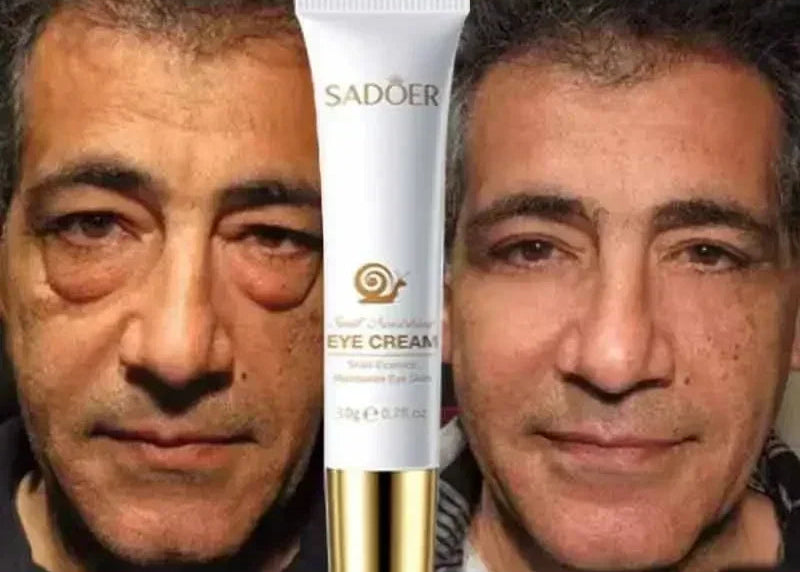 Intant Eye Lift
