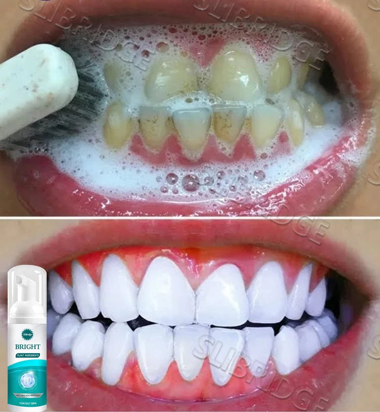 Nettoyage des dents et mousse buccale – Collection avec livraison gratuite