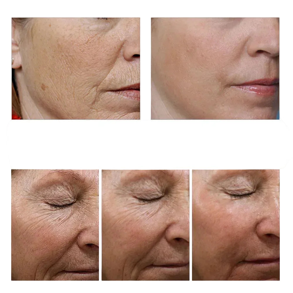 Collagen Glow Booster – Restore Youthful Skin