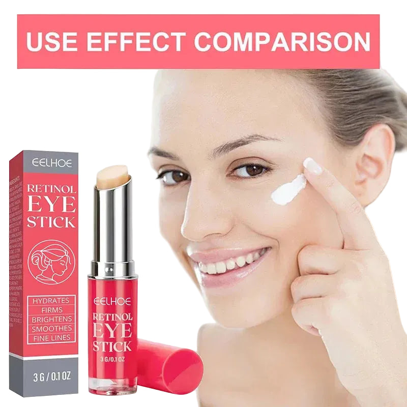 Retinol Eye Cream – Lifting & Dark Circle Treatment