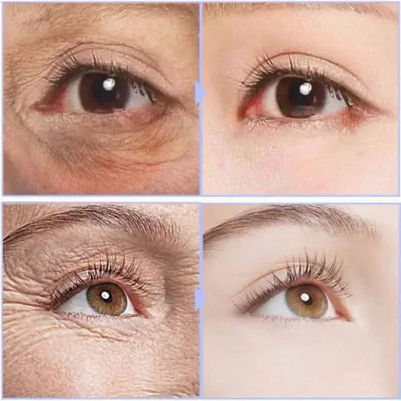 Instant Eye Lift – Visible Results in Seconds