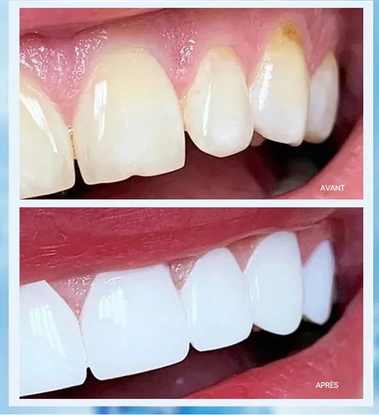 Nettoyage des dents et mousse buccale – Collection avec livraison gratuite