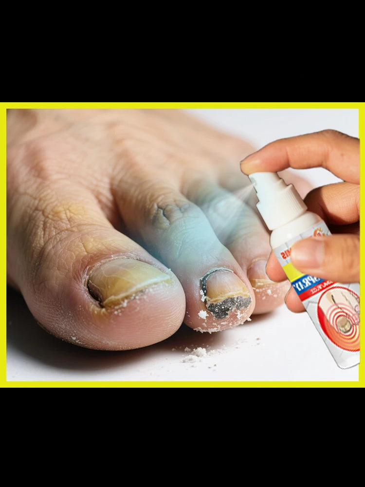 Suero reparador y fortalecedor de uñas: recuperación de daños y potenciador del crecimiento