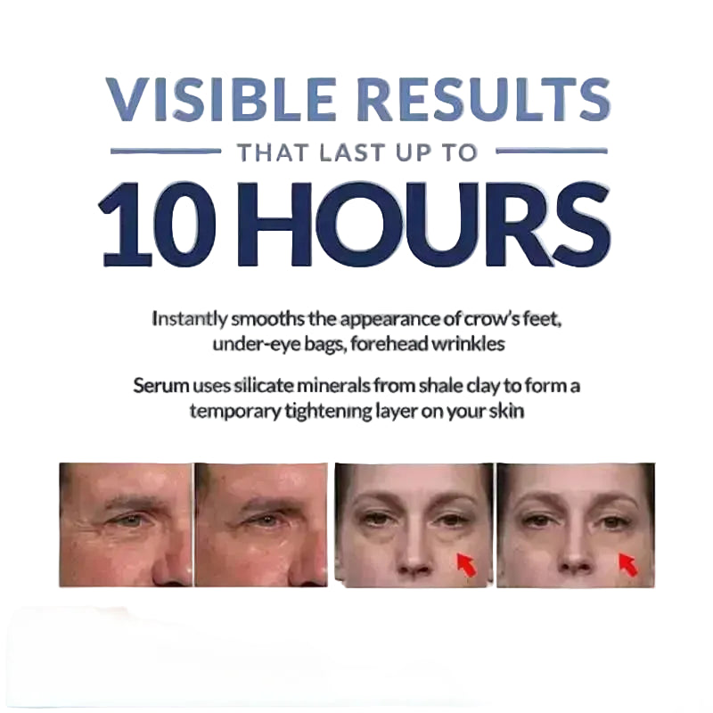 Instant Eye Lift – Visible Results in Seconds