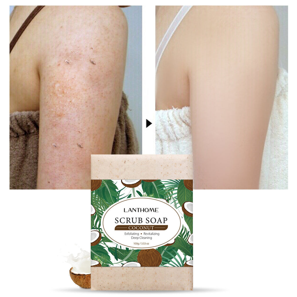 Soap – Essential Oil Cleansing Bar